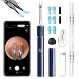 Qimic Ohrenschmalz Entferner Otoskop, 1080P HD WiFi Ohrenreiniger, Ohr Kamera mit Pinzetten & 4 LEDs, Otoskop for iOS & Android, IP67 Wasserdicht Ohrreiniger für Erwachsene, Kinder und Haustier