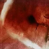 The Death of Kalypso [Vinyl LP]