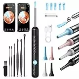 Qimic Ohrenschmalz Entferner Otoskop, WiFi Ohrreiniger, IP67 Wasserdicht und 360°-Weitwinkel Otoskop Kamera mit 6 LEDs für Erwachsene, Kinder und Haustier, Schwarz