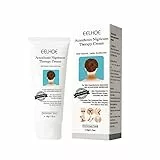 Nigrifree Acanthosis Nigricans Therapy Cream, Dark Spot Corrector Cream Retinol Creme, 50g Acanthosis Nigricans Therapy Cream, Entfernung Von Hyperpigmentierung Für Dunkle Körperteile (1 PCS)
