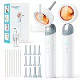 Qimic 1,3v8' Otoskop mit Licht, Ohr Infektions Detektor und Tragbares Hand-Otoskop, leichtes Diagnostik Ohrpflege-Tool für Kinder, Erwachsene, Haustiere, Heimgebrauch, 2000mAh Akku
