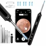 Ohrenschmalz Entferner Otoskop, Qimic WiFi Ohrreiniger, 1080P Ultradünne HD Drahtlos Wasserdicht Ohrenspiegel mit 3.5mm Linse und 6 LEDs für iPhone, iPad und Android-Smartphones