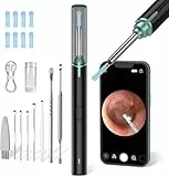 Ohrenschmalz Entferner mit Kamera, AZHE 1920P Ohrenreiniger mit 6 LED, Ohrreiniger IP67 Wasserdicht, mit Wifi für iPhone, iPad und Android-Smartphones (Schwarz)